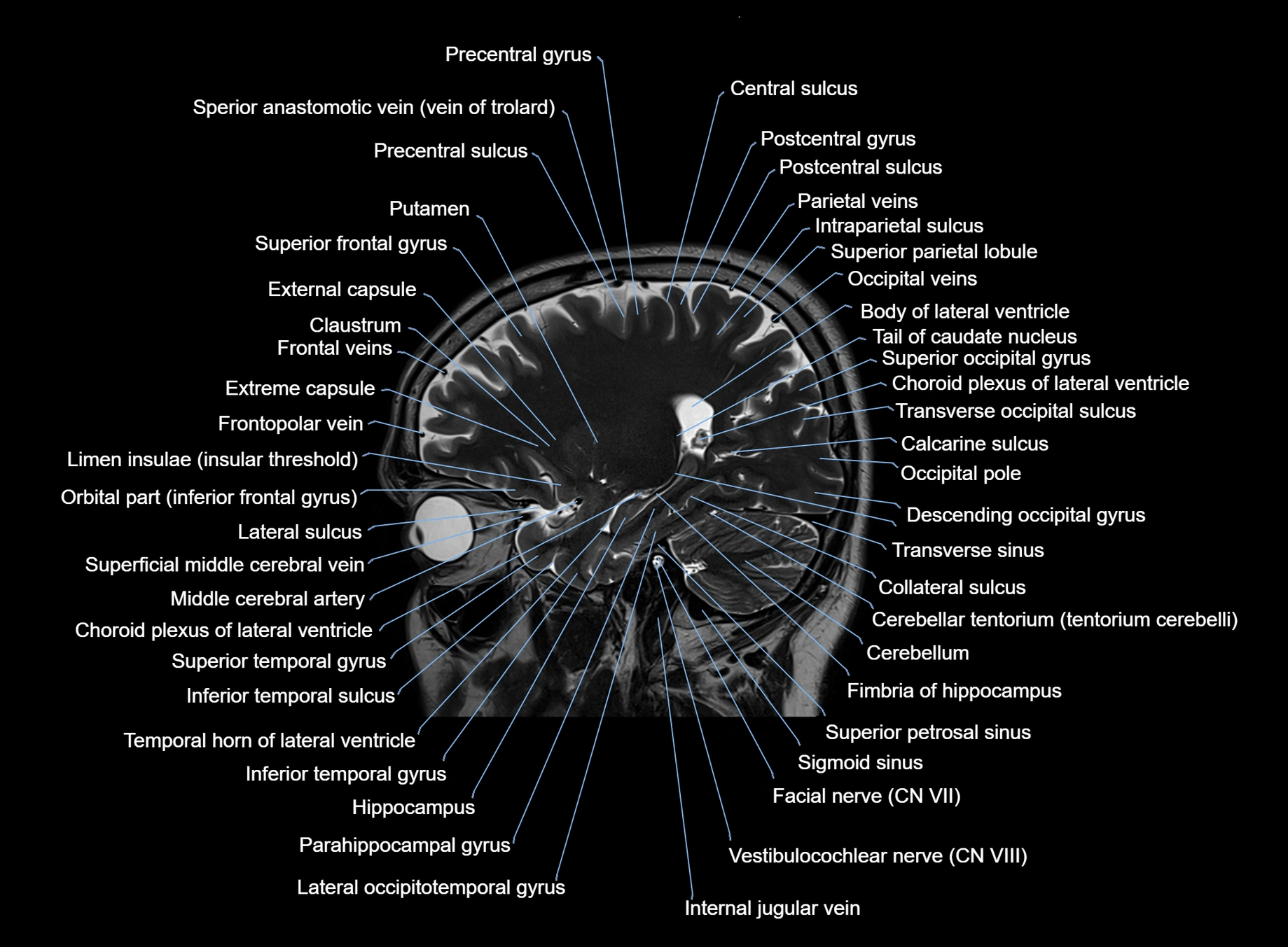 brain sagittal anatomy 3T MRI images -img-00001-00021.webp